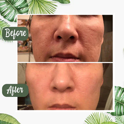 GREEN MASK - ELIMINA IMPUREZAS DEL ROSTRO