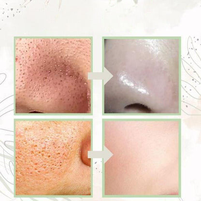 GREEN MASK - ELIMINA IMPUREZAS DEL ROSTRO